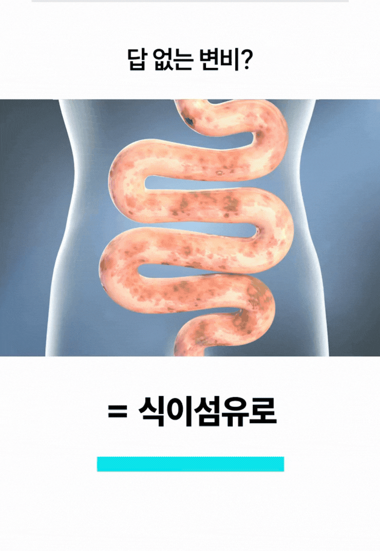 변비해결