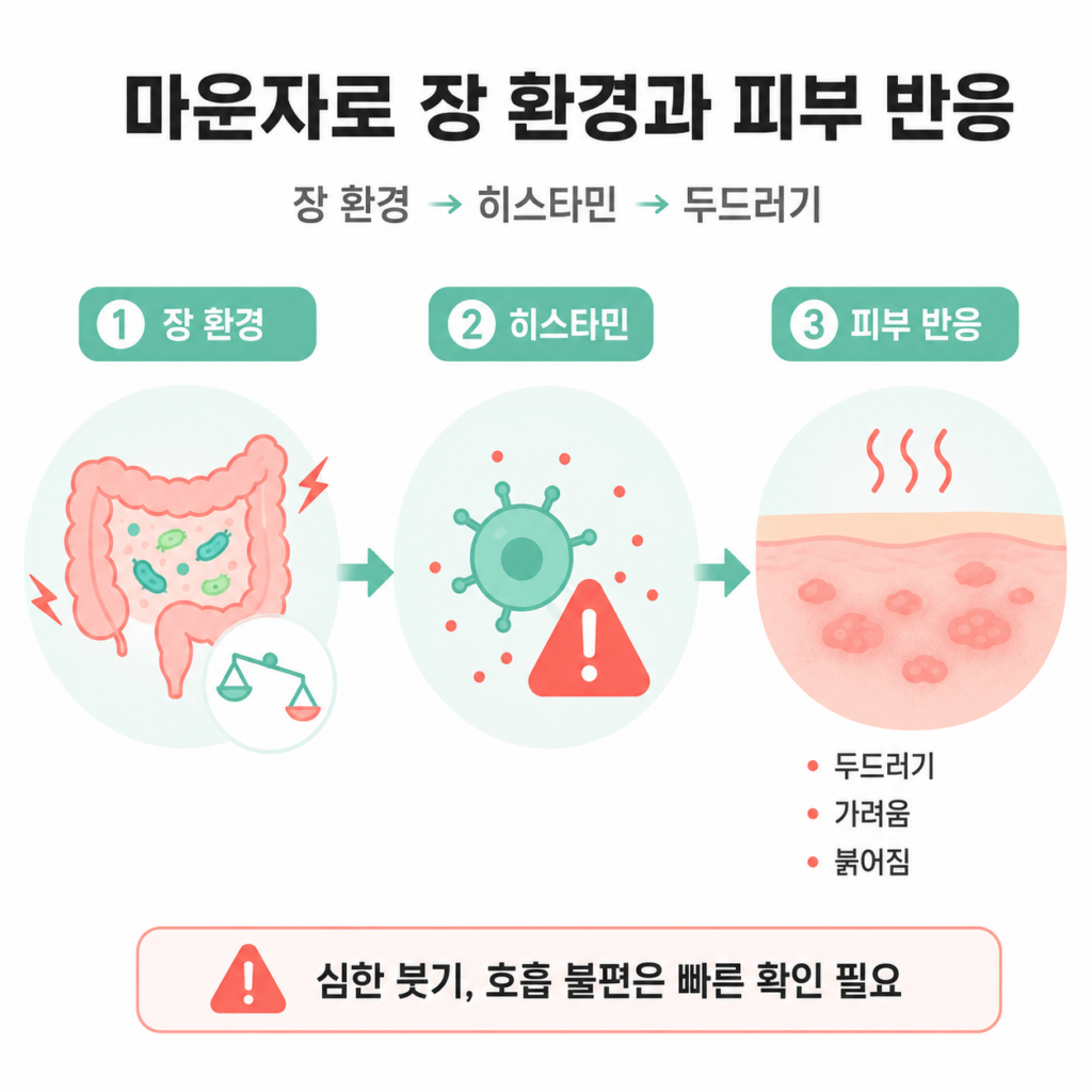 마운자로 장 환경 히스타민 두드러기 피부 반응