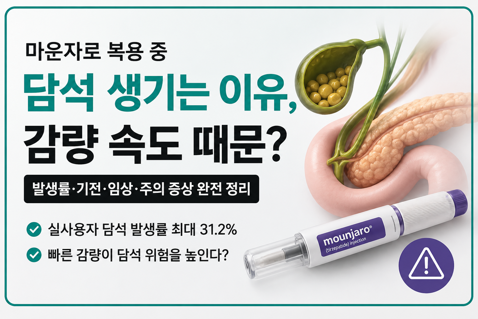 마운자로 부작용 담석 감량 속도가 부르는 원인과 예방 관리법