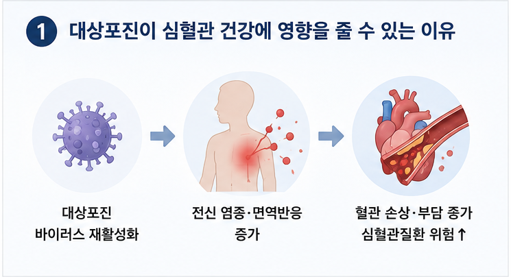 대상포진 염증과 심혈관질환 관계