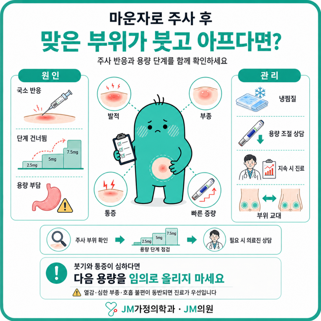 마운자로발진